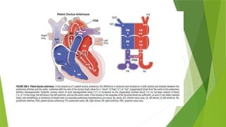 Comprehensive Overview of Congenital Heart Disease Management in ...