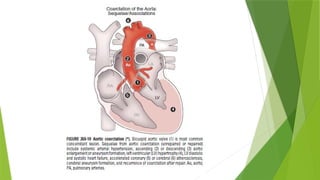 Comprehensive Overview of Congenital Heart Disease Management in ...