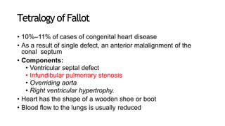 Tetralogy ofFallot
• 10%–11% of cases of congenital heart disease
• As a result of single defect, an anterior malalignment of the
conal septum
• Components:
• Ventricular septal defect
• Infundibular pulmonary stenosis
• Overriding aorta
• Right ventricular hypertrophy.
• Heart has the shape of a wooden shoe or boot
• Blood flow to the lungs is usually reduced
 