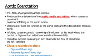 AorticCoarctation
• 5%–10% of congenital cardiac lesions
• Produced by a deformity of the aortic media and intima, which causes a
prominent
posterior infolding of the aortic lumen
• Occurs at or near the junction of the aortic arch and the descending thoracic
aorta
• Infolding cause eccentric narrowing of the lumen at the level where the
ductus or ligamentum arteriosus inserts anteromedially
• Resultant luminal narrowing in turn obstructs the flow of blood from
the left ventricle
• Classic radiologic signs
• Figure-of-three sign
• Reverse figure-of-three sign
 