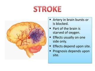  Artery in brain bursts or
is blocked.
 Part of the brain is
starved of oxygen.
 Effects usually on one
side only.
 Effects depend upon site.
 Prognosis depends upon
site.

 