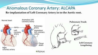 Congenital Heart Disease & Surgical Management | PPTX