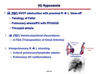 Promixol R Congenital Heart Disease Screening in the Neonate | PPT