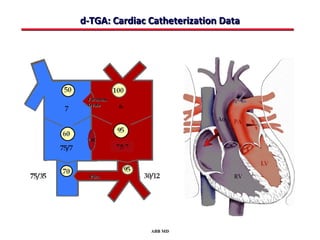 d-TGA: Cardiac Catheterization Data




               ABB MD
 