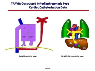 TAPVR: Obstructed Infradiaphragmatic Type
            Cardiac Catheterization Data




     To IVC in anterior view            To IVC/HPV in posterior view




                               ABB MD
 