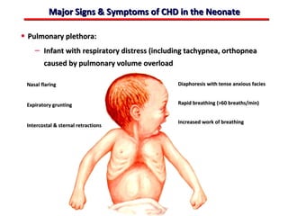 Major Signs & Symptoms of CHD in the Neonate

• Pulmonary plethora:
    – Infant with respiratory distress (including tachypnea, orthopnea
        caused by pulmonary volume overload

 Nasal flaring                                Diaphoresis with tense anxious facies


 Expiratory grunting                          Rapid breathing (>60 breaths/min)


                                              Increased work of breathing
 Intercostal & sternal retractions




                                     ABB MD
 