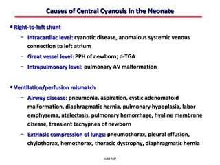 Causes of Central Cyanosis in the Neonate

• Right-to-left shunt
    – Intracardiac level: cyanotic disease, anomalous systemic venous
      connection to left atrium
    – Great vessel level: PPH of newborn; d-TGA
    – Intrapulmonary level: pulmonary AV malformation


• Ventilation/perfusion mismatch
    – Airway disease: pneumonia, aspiration, cystic adenomatoid
      malformation, diaphragmatic hernia, pulmonary hypoplasia, labor
      emphysema, atelectasis, pulmonary hemorrhage, hyaline membrane
      disease, transient tachypnea of newborn
    – Extrinsic compression of lungs: pneumothorax, pleural effusion,
      chylothorax, hemothorax, thoracic dystrophy, diaphragmatic hernia

                                   ABB MD
 