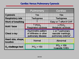 Cardiac Versus Pulmonary Cyanosis




              ABB MD
 