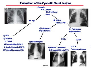 Evaluation of the Cyanotic Shunt Lesions
                                      Cyanotic:
                                         R to L Shunt
                                                 Bi-directional
                                                Shunt


                              PBF                        PBF or
                                                           Normal PBF

                                       (+) Pulmonary                           (-) Pulmonary
                                        Hypertension                           Hypertension

1) TGA
2) Truncus                                                         (+) LV             (+) RV
  3) TAPVR                   1) Eisenmenger’s
 4) Taussig-Bing (DORV)
5) Single Ventricle (DILV)                         1) Ebstein’s Anomaly         1) TOF              2
6) Tricuspid Atresia/VSD                            2) Tricuspid Atresia/IVS    Pulmonary Atresia




                                            ABB MD
 