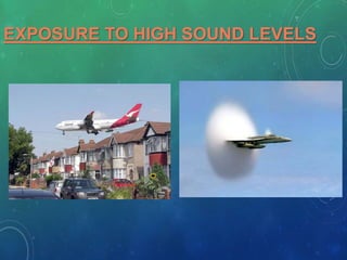 EXPOSURE TO HIGH SOUND LEVELS
 