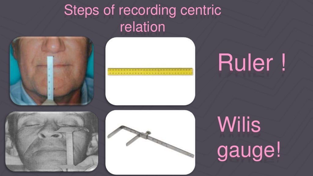 Check bite technique