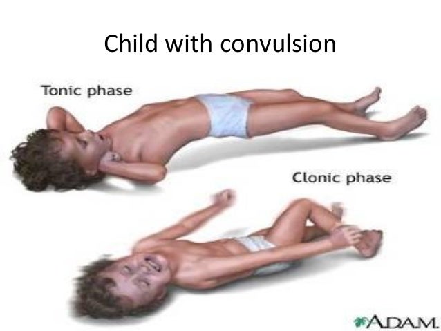 Orgasmic Convulsions
