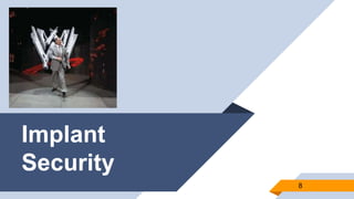 Implant
Security
8
 