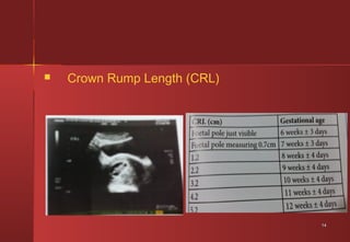 Check point of estimation of gestational age and viability of fetus | PPT