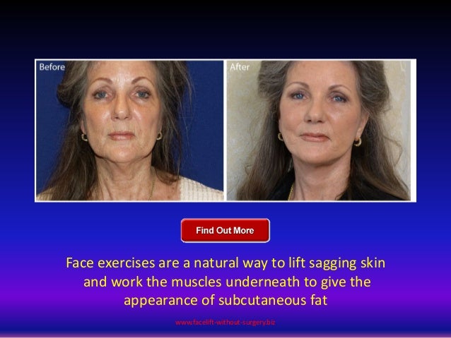 sunken tighten flabby plumping sagging