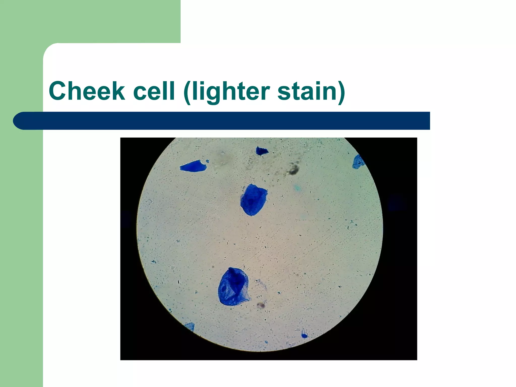 Cheek cell (lighter stain)
 