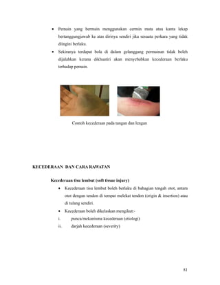 •   Pemain yang bermain menggunakan cermin mata atau kanta lekap
          bertanggungjawab ke atas dirinya sendiri jika sesuatu perkara yang tidak
          diingini berlaku.
      •   Sekiranya terdapat bola di dalam gelanggang permainan tidak boleh
          dijalahkan kerana dikhuatiri akan menyebabkan kecederaan berlaku
          terhadap pemain.




                    Contoh kecederaan pada tangan dan lengan




KECEDERAAN DAN CARA RAWATAN


      Kecederaan tisu lembut (soft tissue injury)
          •     Kecederaan tisu lembut boleh berlaku di bahagian tengah otot, antara
                otot dengan tendon di tempat melekat tendon (origin & insertion) atau
                di tulang sendiri.
          •     Kecederaan boleh dikelaskan mengikut:-
          i.        punca/mekanisma kecederaan (etiologi)
          ii.       darjah kecederaan (severity)




                                                                                  81
 