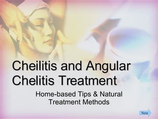 Cheilitis and Angular Chelitis Treatment Home-based Tips & Natural Treatment Methods Next 