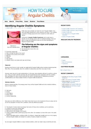 Home

About Us

Privacy Policy

Contact

Disclaimer

Press Release

Identifying Angular Cheilitis Symptoms
by Kathleen Hattan on Sunday, December 15th, 2013 | 3 Comments

W hile many have probably not heard the term “Angular Cheilitis”, they
have most likely experienced or seen someone w ho has it. The condition
is common in all age groups and can be caused by a w ide variety of
factors.
Furthermore, Angular Cheilitis Symptoms can be quite easy to
identify. For the average person w ith no medical know ledge, there are
plenty of signs and symptoms to look out for w hen attempting to
diagnose Angular Cheilitis.

Image Source –
http://www.medicaljournals.se

RECENT POSTS
Angular Cheilitis Treatment w ith Antibiotics
Angular Cheilitis Treatment Using Antiseptics
Angular Cheilitis Diet
The Importance of Angular Cheilitis
Treatment
Causes of Angular Cheilitis

ANGULAR CHEILITIS TREATMENT

The following are the signs and symptoms
of Angular Cheilitis:
Skin discoloration (most often red)
Inflammation

Extremely chapped lips
Pain or at least one side of the mouth
Cracking at the corners of the mouth
Blistering
Lesions
Skin dryness
Irritation (w hich can include both pain and itching)

CATEGORIES
Causes
Signs and symptoms
Treatments

Diagnosis
Keeping these factors in mind, people can easily identify Angular Cheilitis w ithout seeking medical expertise.
Most often, this is acceptable, since the condition is rarely serious and often very easy to treat.

OUR PRESS RELEASE
Click to Read it Here >>

How ever, some may opt to seek medical advice. In this case, many physicians w ill w ant to perform a culture
test. These can help to identify bacterial, viral, and fungal infections often associated w ith the condition.
More specifically, the culture test(s) performed can detect microbial strains of Staphylococcus aureus,
Candida albicans, and Herpes simplex involved in Angular Cheilitis development.

Mistaken Identity
W ithout medical expertise, the average person may confuse Angular Cheilitis and other medical conditions.
Some of these include;

RECENT COMMENTS
val yenko on Identifying Angular Cheilitis
Symptoms
matt n. on Causes of Angular Cheilitis
francis w oods on The Importance of
Angular Cheilitis Treatment
sarah evanston on Angular Cheilitis Diet
sarah evanston on Identifying Angular
Cheilitis Symptoms

Cold sores
Herpes
Fever blisters
Mouth ulcers
Severly chapped lips

How does one tell the difference, then? Well, it does have its ow n set of symptoms that are unique and do
not fit the description of these other conditions. Some key differences include;

Time length- it tends to last much longer than some of these other conditions, such as cold sores.
Locations of sores and cracking differ.
Beginning and development differ.
Only occurs on the outside of the mouth.
Certain conditions affect specific age groups more often. For example, it is more often seen in the older
population.
Causes (especially w eather conditions) differ. For instance, chapped lips typically only occur in dry regions,
w hereas Angular Cheilitis can develop for a variety of reasons, despite the w eather.

So once again, Angular Cheilitis is a unique medical condition, w hich can make it easy to identify and treat.

converted by Web2PDFConvert.com

 