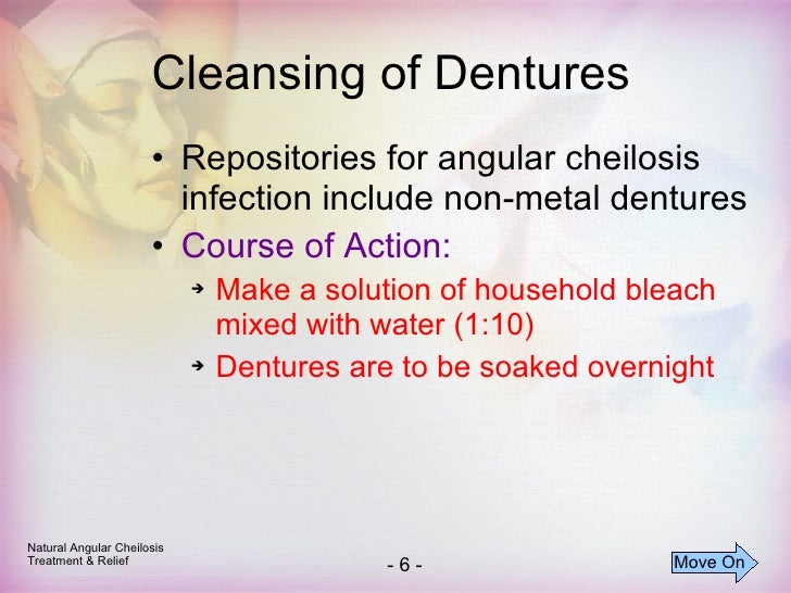Cheilosis and Angular Cheilosis Treatment Natural Treatment For Ang…
