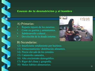 Causas de la desnutrición y el hambre A) Primarias: Reparto injusto de los recursos. Coste en guerras y armamentos. Subdesarrollo cultural. Devolución de la deuda externa. B) Secundarias: Insuficiente rendimiento por hectárea. Almacenamiento/ distribución alimentos. Precio elevado de los cereales.  Catástrofes naturales. Alto crecimiento demográfico. Rigor del clima y geografía. Malos hábitos alimentarios. 