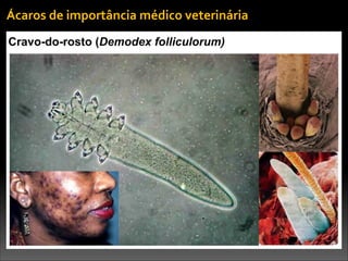 Cravo-do-rosto (Demodex folliculorum)
Ácaros	
  de	
  importância	
  médico	
  veterinária
 