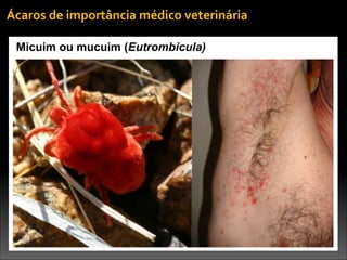 Micuim ou mucuim (Eutrombicula)
Ácaros	
  de	
  importância	
  médico	
  veterinária
 
