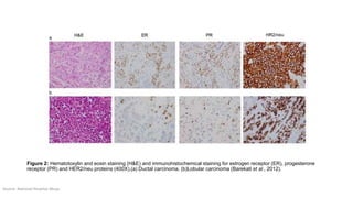 EXPLORING THE CONCEPT OF MULTIPLEXING IN IMMUNOHISTOCHEMISTRY | PPTX