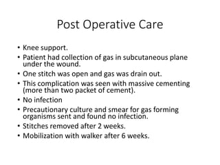 Post Operative Care
• Knee support.
• Patient had collection of gas in subcutaneous plane
under the wound.
• One stitch was open and gas was drain out.
• This complication was seen with massive cementing
(more than two packet of cement).
• No infection
• Precautionary culture and smear for gas forming
organisms sent and found no infection.
• Stitches removed after 2 weeks.
• Mobilization with walker after 6 weeks.
 