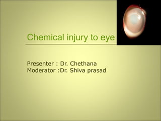 Chemical injury to eye
Presenter : Dr. Chethana
Moderator :Dr. Shiva prasad
 