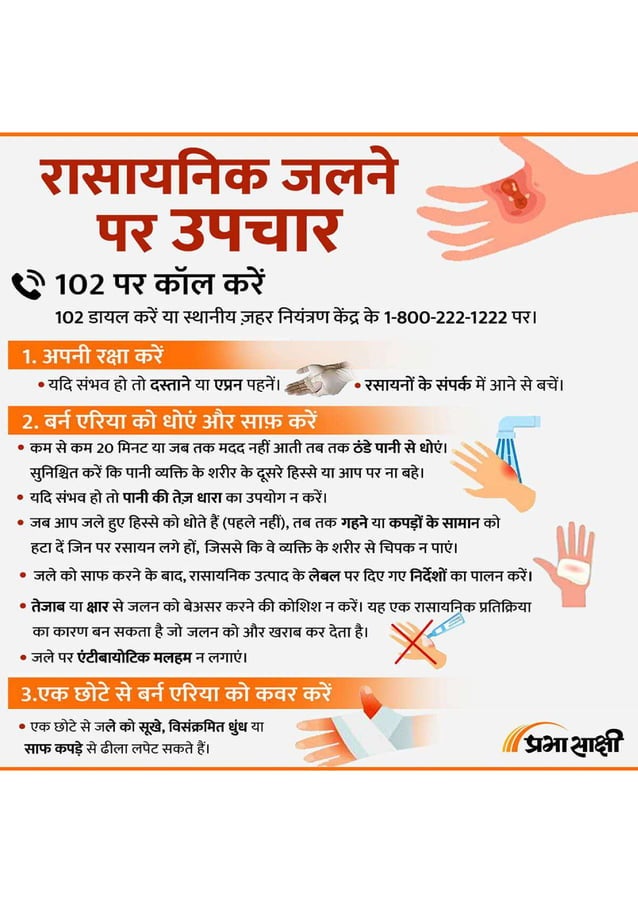 Chemical Burns Treatment Infographics in Hindi