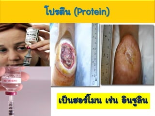 โปรตีน (Protein)
เป็นฮอร์โมน เช่น อินซูลิน
 