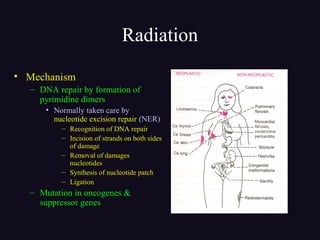 Radiation
• Mechanism
– DNA repair by formation of
pyrimidine dimers
• Normally taken care by
nucleotide excision repair (NER)
– Recognition of DNA repair
– Incision of strands on both sides
of damage
– Removal of damages
nucleotides
– Synthesis of nucleotide patch
– Ligation
– Mutation in oncogenes &
suppressor genes
 