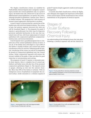 Hughes Classification Chemical burn | PDF