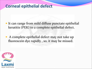 Corneal epithelial defect
 It can range from mild diffuse punctate epithelial
keratitis (PEK) to a complete epithelial defect.
 A complete epithelial defect may not take up
fluorescein dye rapidly , so, it may be missed.
 