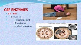 CSF ENZYMES
 CK – BB:
 -Increase in:
 epileptic patient
 Brain tumor
 cerebral infarction
 