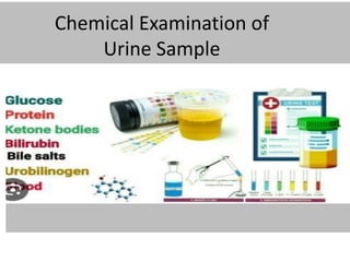 Chemical Examination of
Urine Sample
 