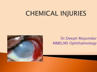 Dr.Deepti Mujumdar
MBBS,MS Ophthalmology
 