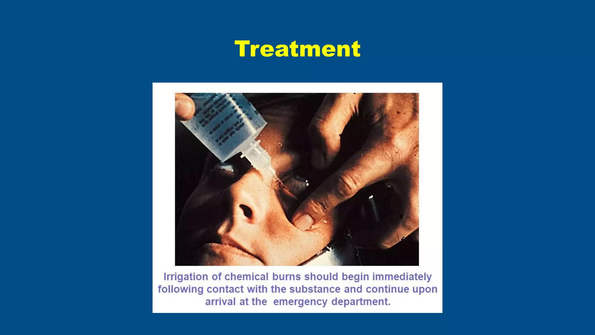 Chemical Injuries.pptx