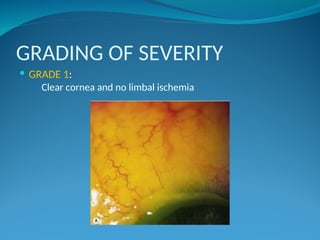 Chemical Injuries optometry slides(1).ppt