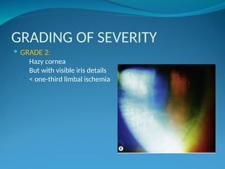 Chemical Injuries optometry slides(1).ppt