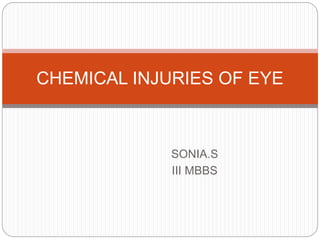SONIA.S
III MBBS
CHEMICAL INJURIES OF EYE
 