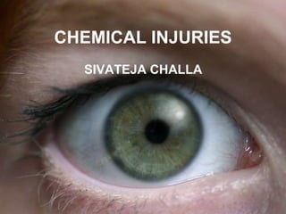 CHEMICAL INJURIES
SIVATEJA CHALLA
 