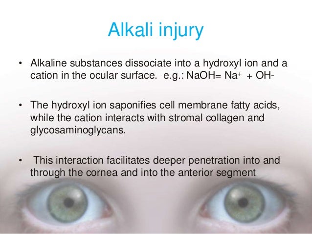 chemical injuries of the eye