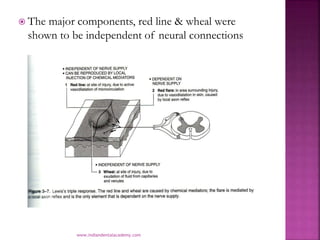  The major components, red line & wheal were
shown to be independent of neural connections
www.indiandentalacademy.com
 