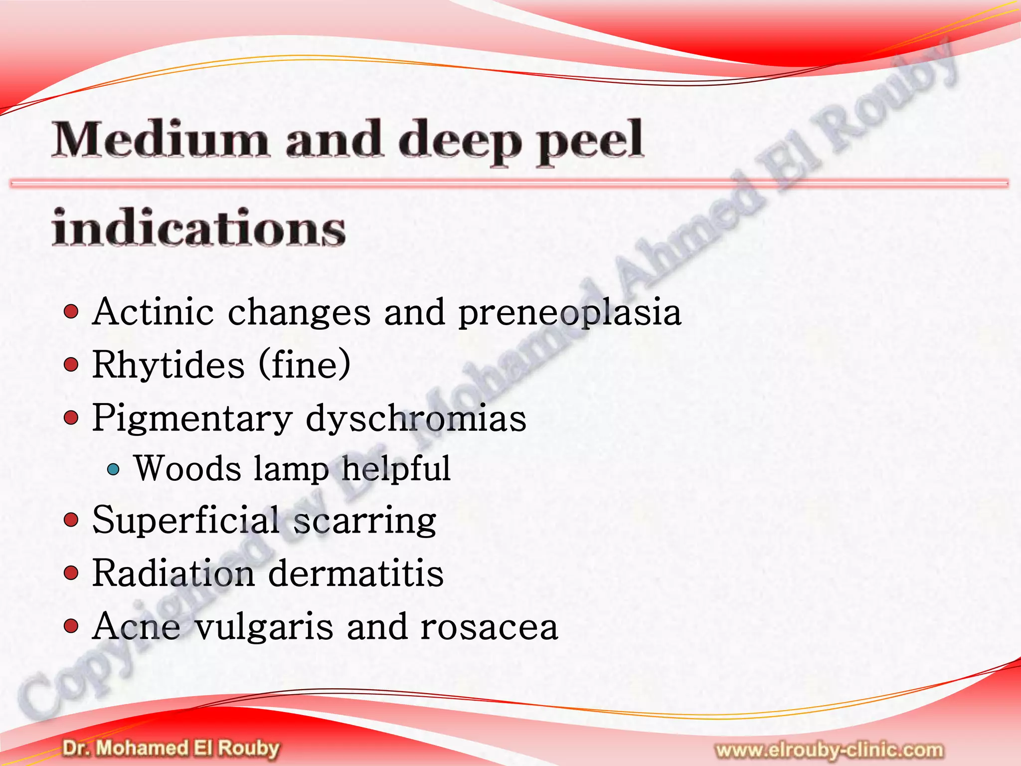 Chemical peel