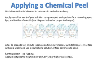Wash face with mild cleanser to remove dirt and oil or makeup
Apply a small amount of peel solution to a gauze pad and apply to face - avoiding eyes,
lips, and insides of nostrils (see diagram below for proper technique).
After 30 seconds to 1 minute (application time may increase with tolerance), rinse face
with cold water and use a neutralizing solution, if face continues to sting.
Gently pat skin – no rubbing.
Apply moisturizer to nourish new skin. SPF 30 or higher is essential.
 