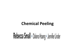 Chemical Peeling
 