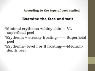 According to the type of peel applied
Examine the face and wait
*Minimal erythema +shiny skin--- VL
superficial peel
*Erythema + streaky frosting------ Superficial
peel
*Erythema+ level I or II frosting----Medium-
depth peel
 