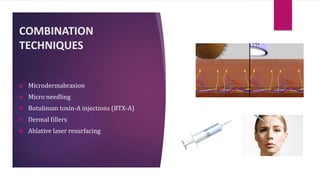 COMBINATION
TECHNIQUES
 Microdermabrasion
 Micro needling
 Botulinum toxin-A injections (BTX-A)
 Dermal fillers
 Ablative laser resurfacing
 